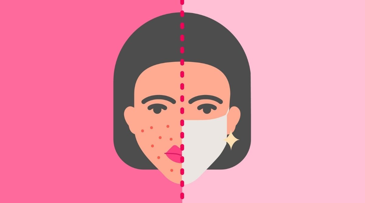 What is Maskne and How Do I Deal With it?